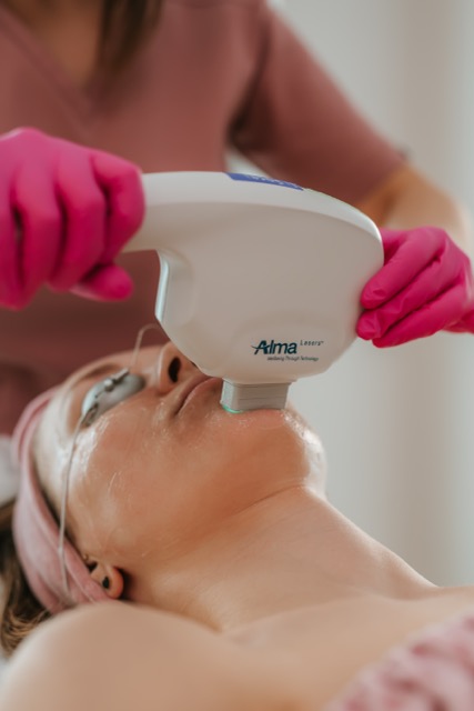 Zabieg Alma Laser na twarz w gabinecie kosmetologii i medycyny estetycznej